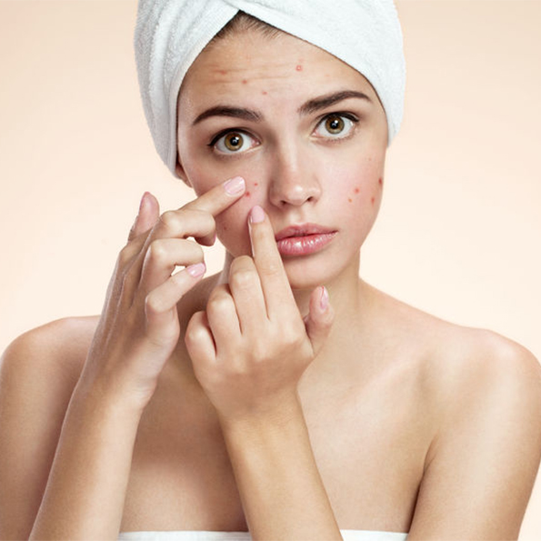 prevenir-tratar-acne-productos-limpiadores